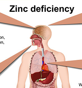 FIRST SIGNS OF LOW ZINC (A ZINC DEFICIENCY)