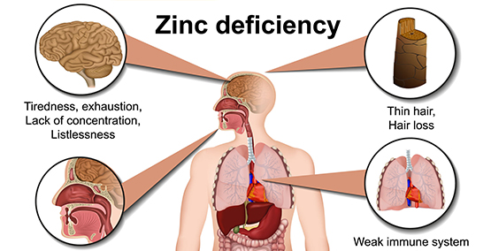 FIRST SIGNS OF LOW ZINC (A ZINC DEFICIENCY)
