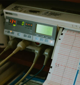 MONITORING METHOTREXATE