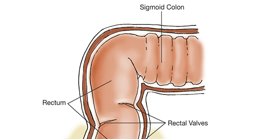 RECTAL MEDICINES FOR IBD