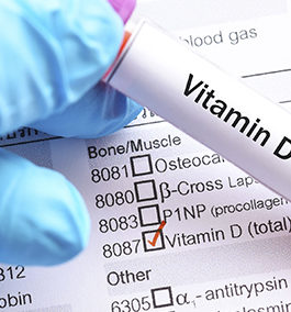 TESTS FOR VITAMIN D