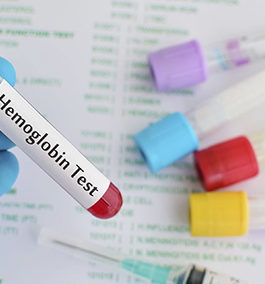 USING HEMOGLOBIN COUNT IN IBD